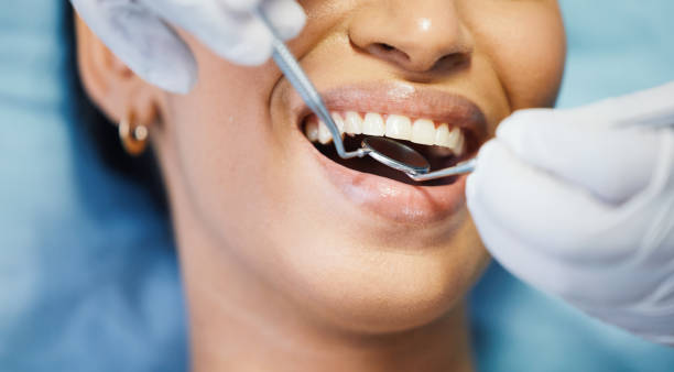Best Emergency Root Canal Treatment in Morrow, GA
