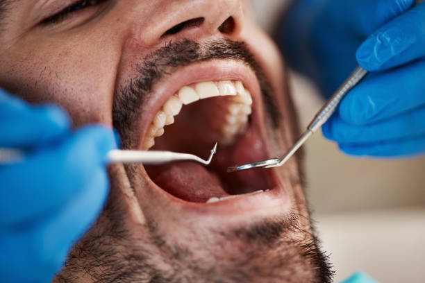 Best Emergency Broken Tooth Repair in Morrow, GA