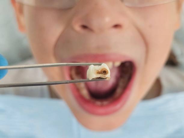 Best Emergency Dental Surgery in Morrow, GA